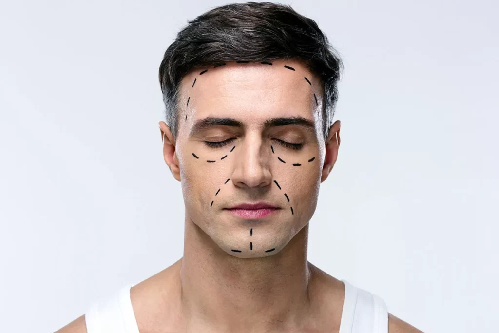 plastic surgery for men 1