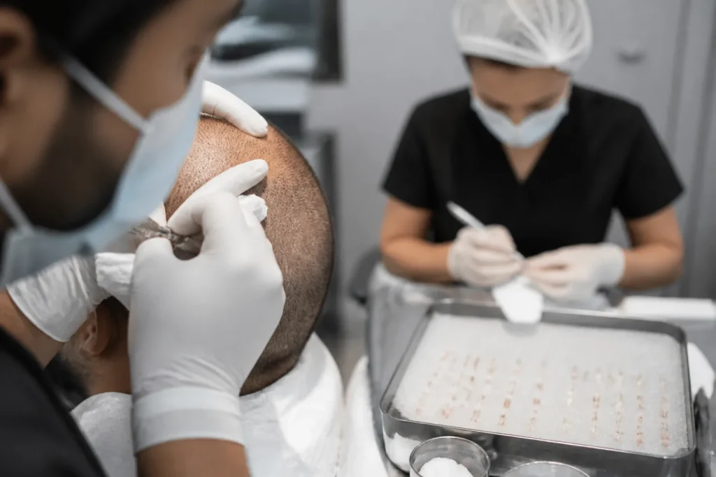 technology advances in hair transplant procedures in turkey 20260915 210140 002