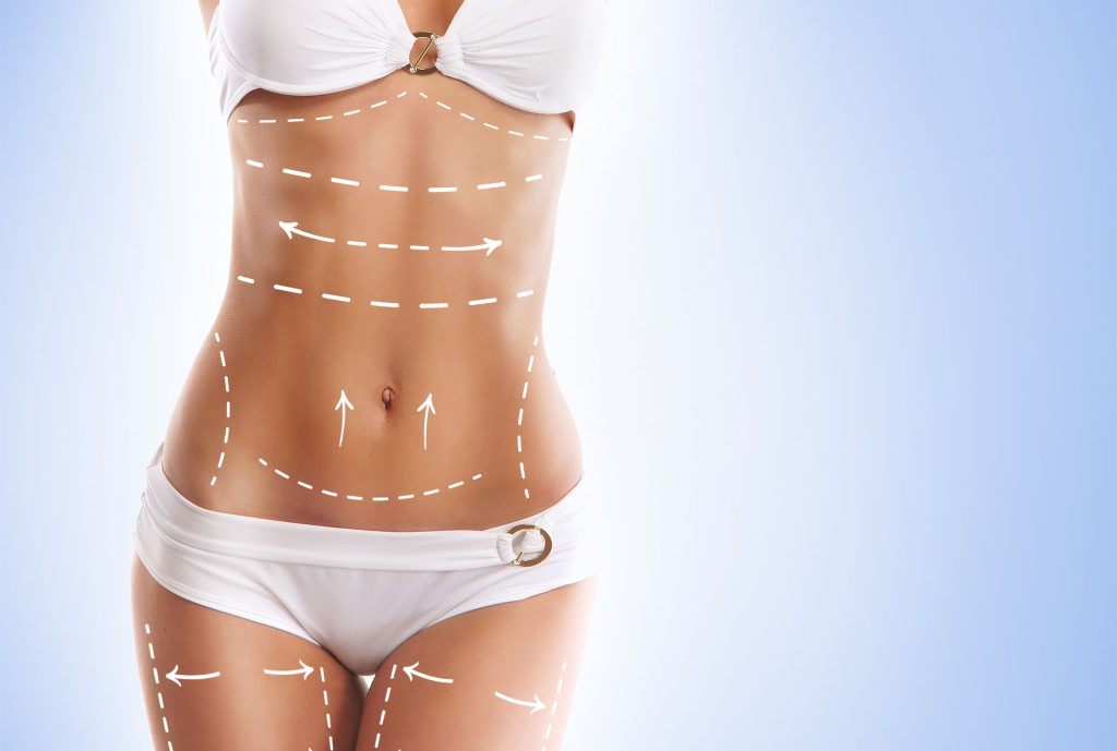 Facts Behind VASER Liposuction Recovery