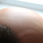 Thinning and Receding Hairline: What to Do